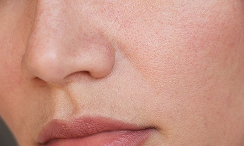 Pores dilatés : Découvrez toutes nos solutions